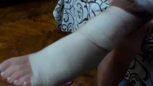 Girl Putting on Tan Nylon over Bandage